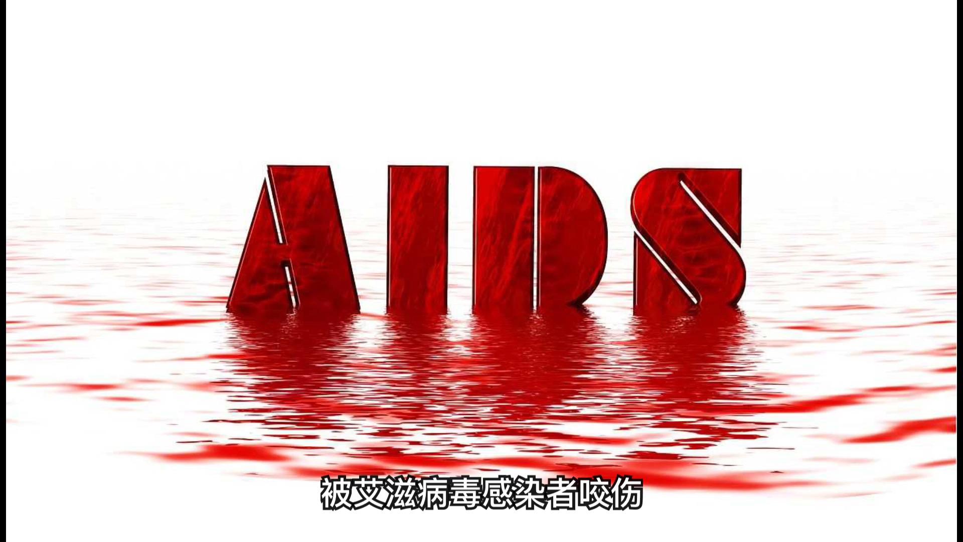 艾滋病感染者会过早衰老?治疗研究又有新进展