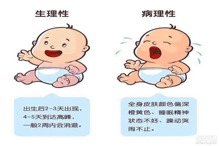 如何识别新生儿黄疸 - 知乎