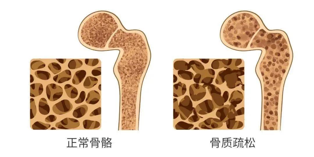 v2-f2b29bcb96fc6396b9c0800011a055d3_1440w.jpg?source=172ae18b