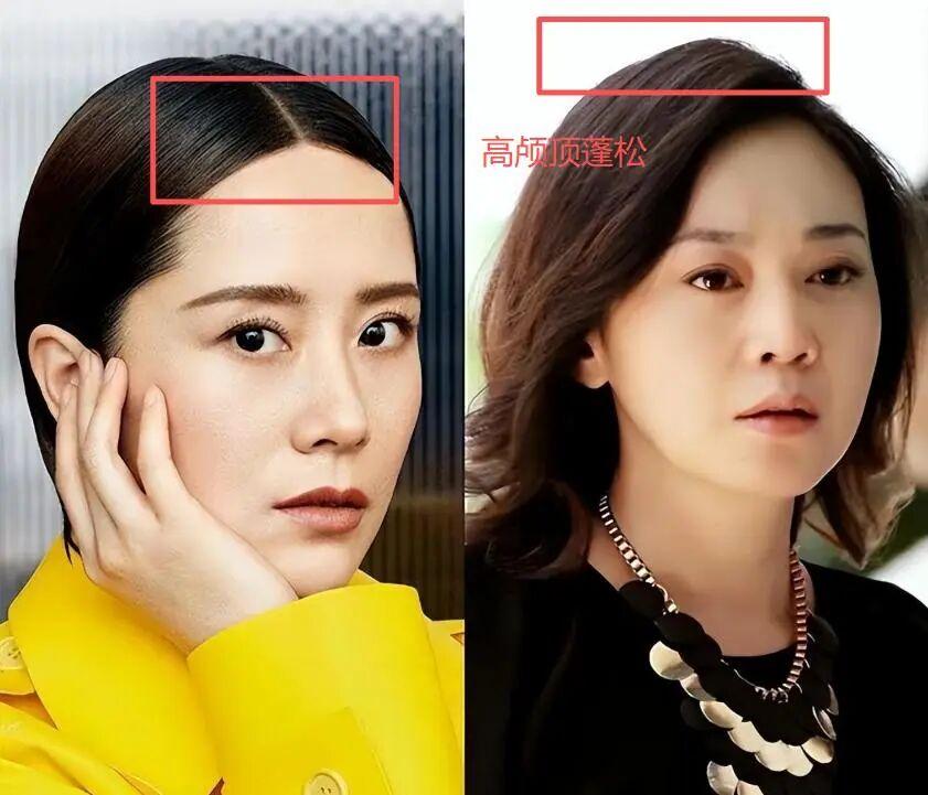 “披发”有多显老？看这些素人对比图就知道：一下子老10岁 - 知乎