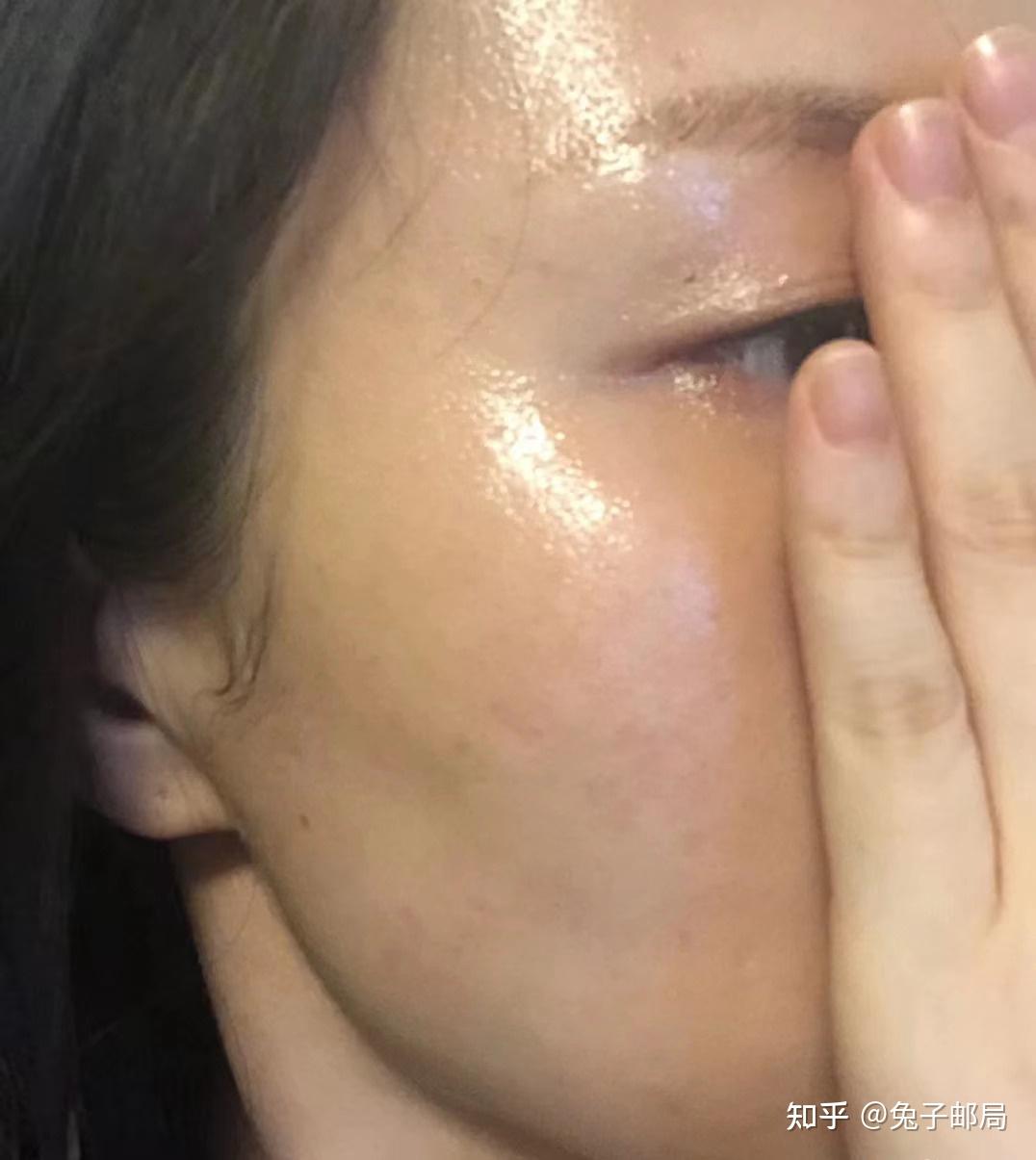 脸色太黄了怎么美白