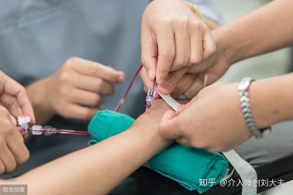 子宫肌瘤与介入栓塞的那些事 知乎