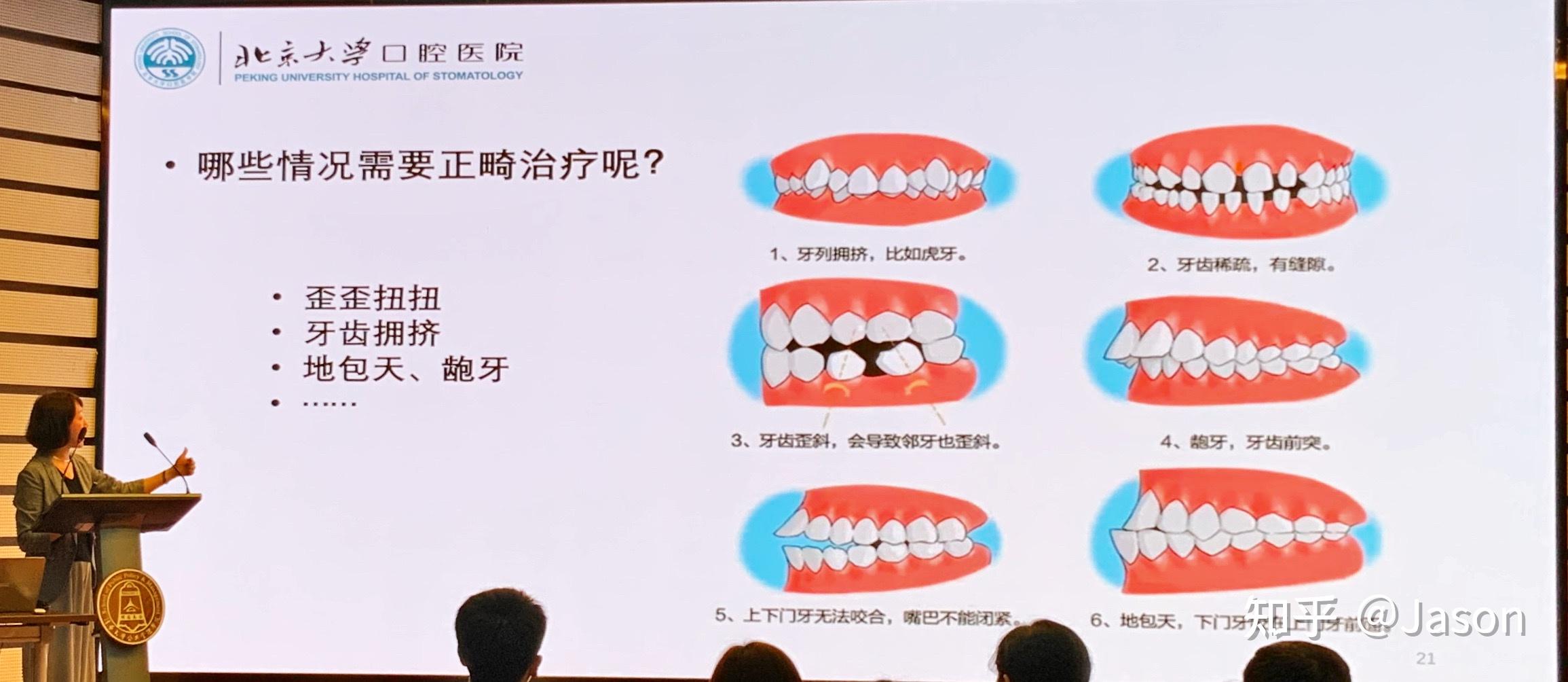 北大一院黄牛在线免费咨询的简单介绍