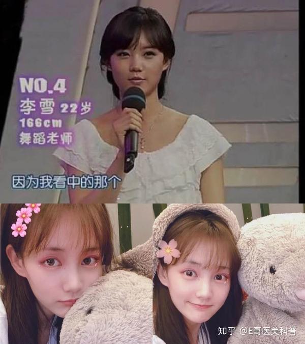 AI换脸 DeepFaceLab liae丹 李一桐采访-bilibili(B站)无水印视频解析——6li6在线工具箱