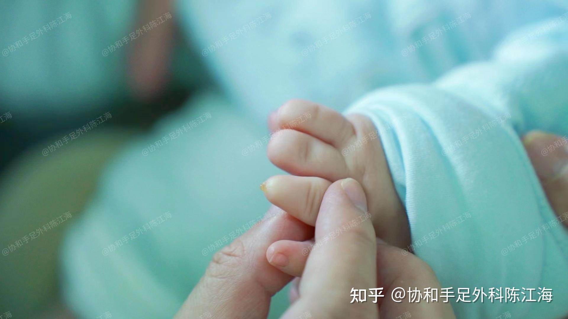 束带综合征产检能查出来吗?早发现,早干预,结果会不会不一样? - 知乎