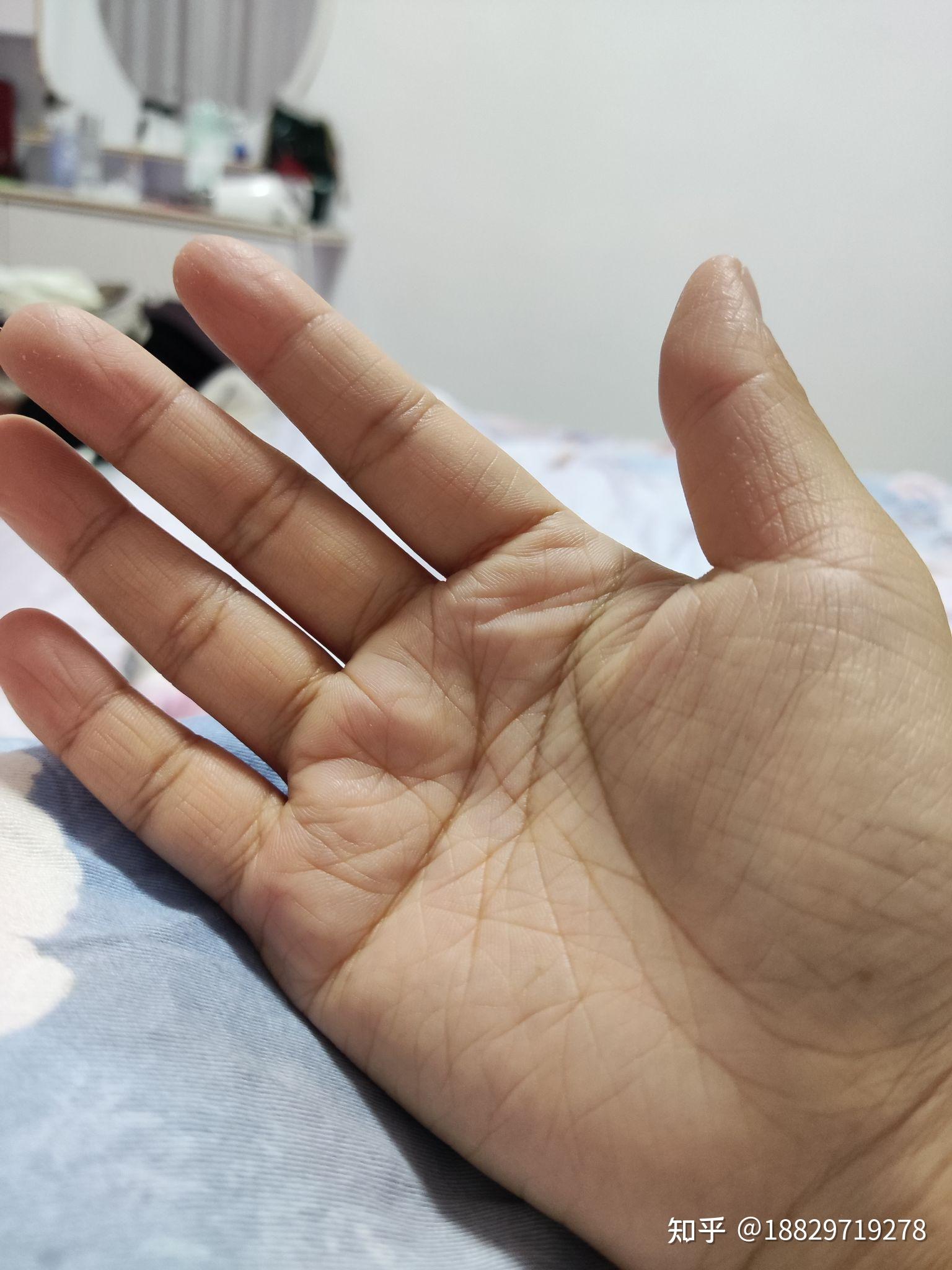 就很深后来发现和别人比起来我的手掌很粗糙但是手背不糙怎样能改善呢