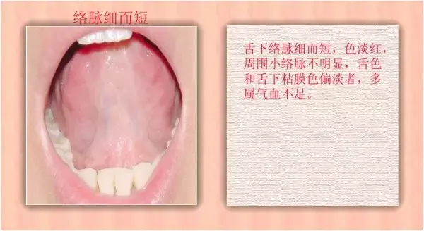 中医医生总看舌头都在看什么?九种体质+珍贵的舌诊图谱! - 知乎