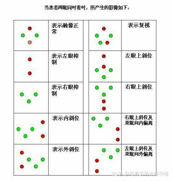 复视像检查图解读图片