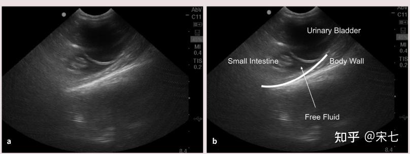 猫传腹(fip)的影像诊断