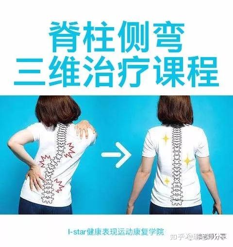 瑜老师北京站10月25至28日istar运动康复学院脊柱侧弯三维治疗课程