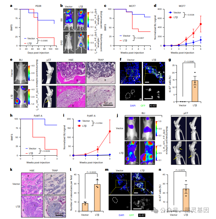 Nat Cell Bio | 清华青大联合：乳腺癌骨转移中骨微环境的变化 - 知乎