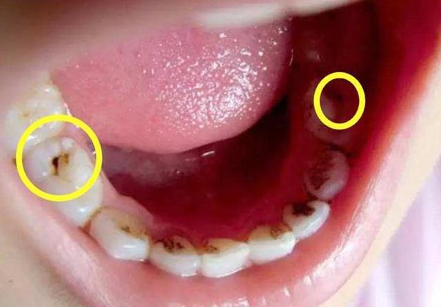 怎样减少黑色色素 v2-f5267cbc0000eecb04616b6afe9cc3d5_1440w.jpg?source=172ae18b