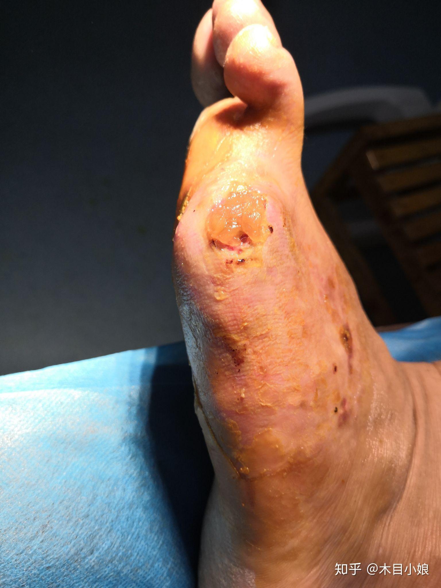 有哪些看着就很疼的照片视频