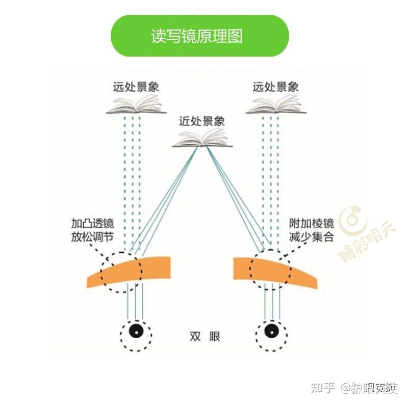 佩戴读写镜,也就是棱透组合镜,它采用低度凸透镜附加基底向内的三棱