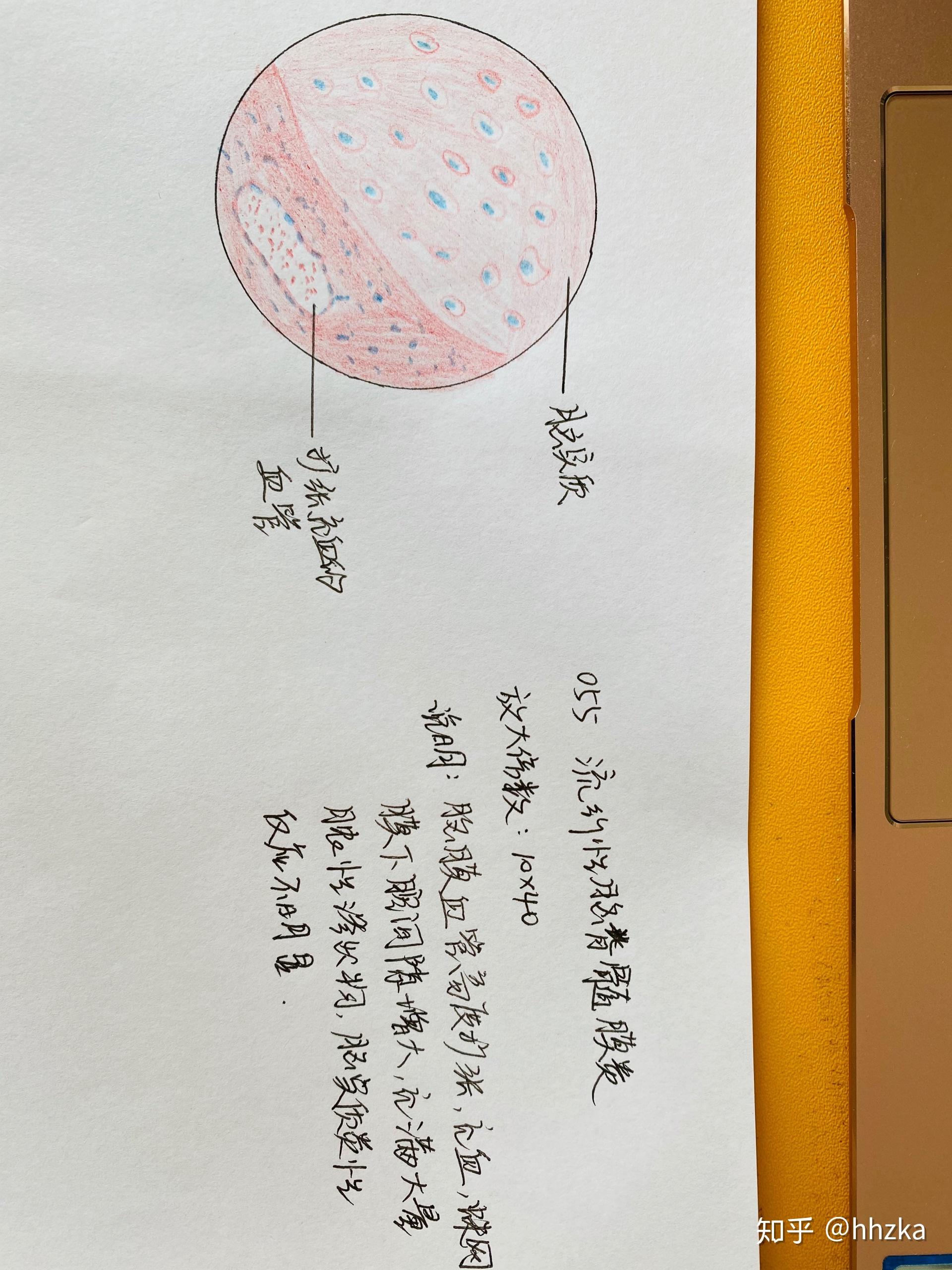 病理学切片红蓝铅手绘图