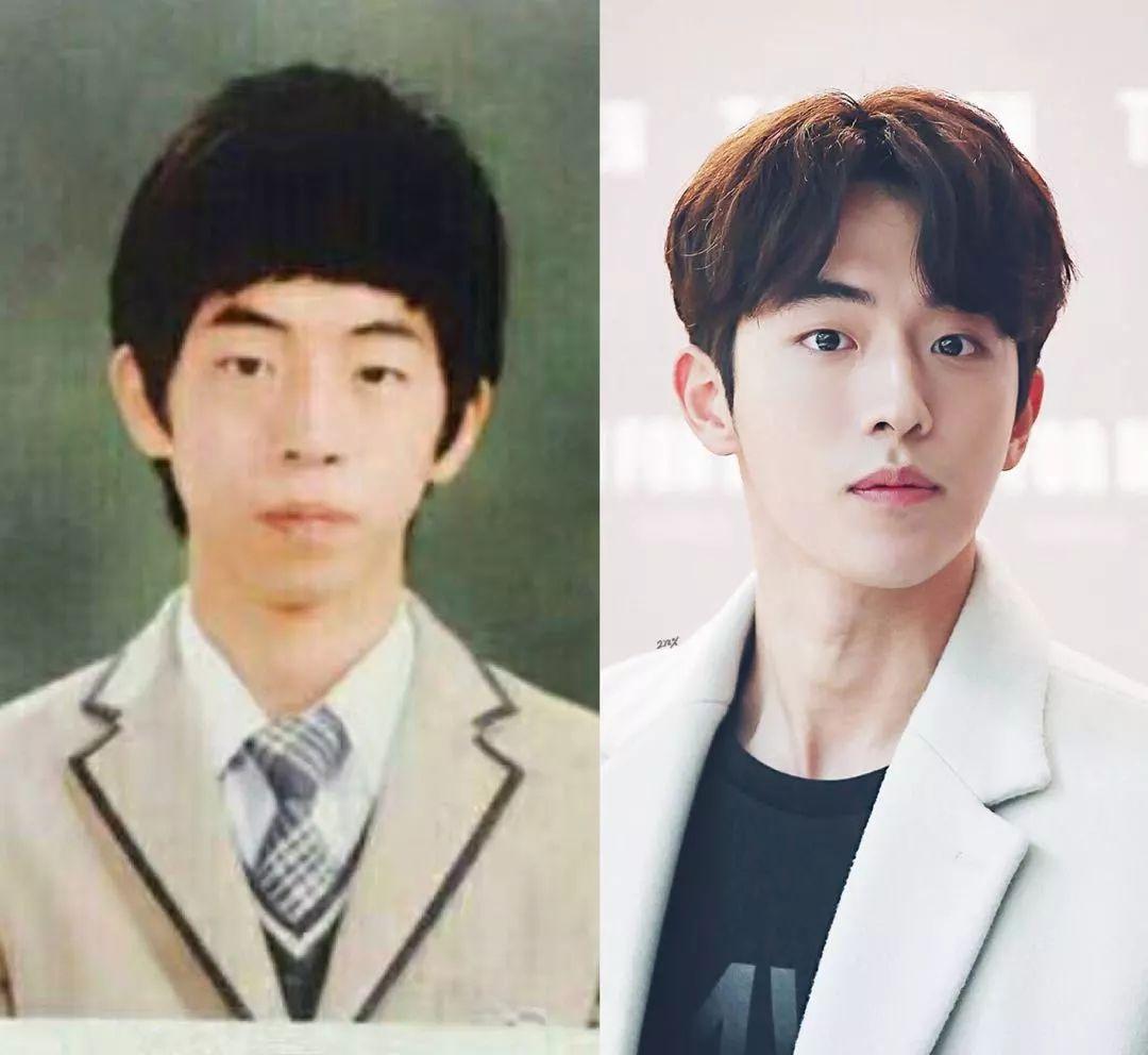 在韩国超级火的"男朋友"南柱赫在早期也是戴了牙套,而且还非常大方的