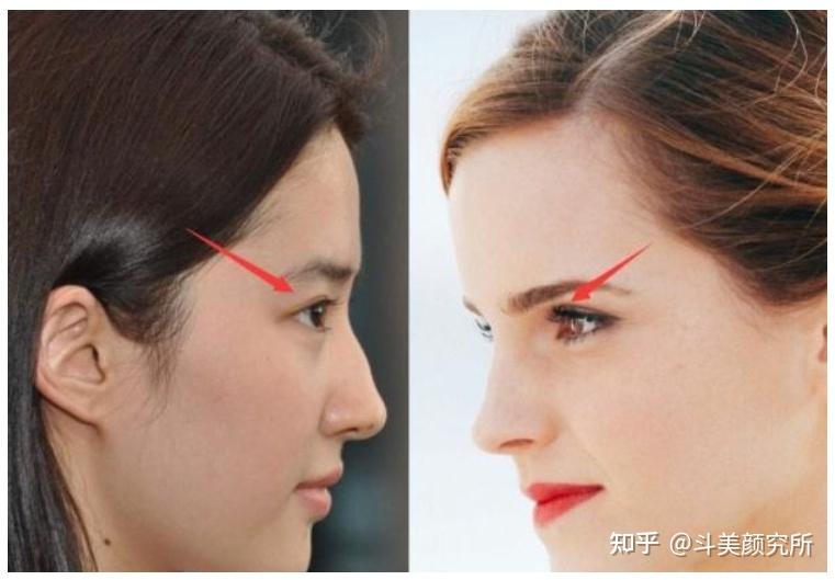 do眉弓到底有多香?do眉弓有哪些方式,哪种效果比较好?价格怎么样?
