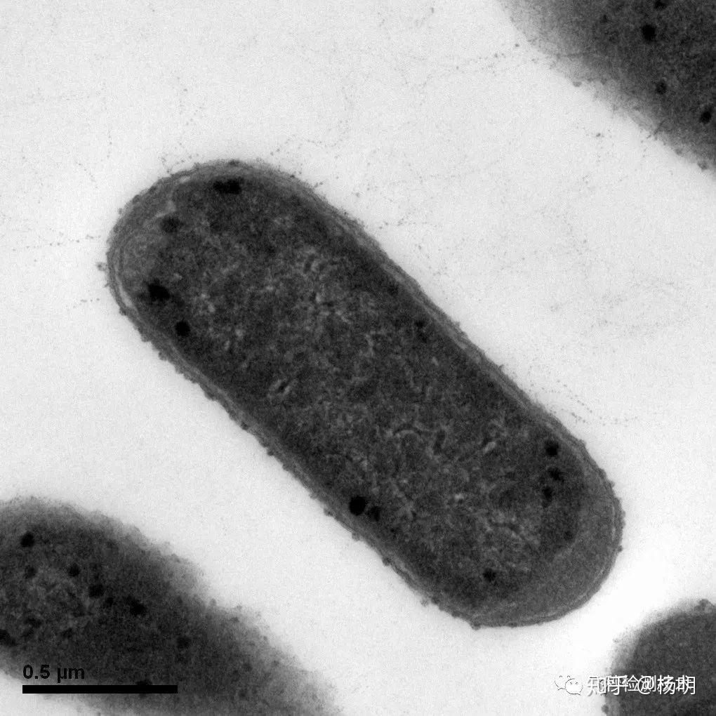 大肠杆菌电子显微镜图片