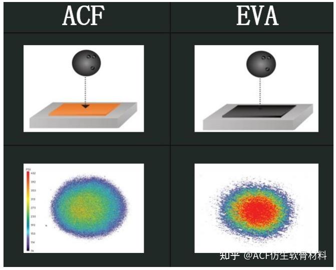 减振阻尼材料的新领袖：ACF人工软骨材料 - 知乎