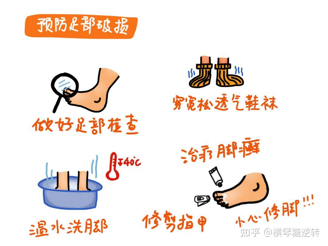 糖尿病患者护理不当足小心有截肢风险