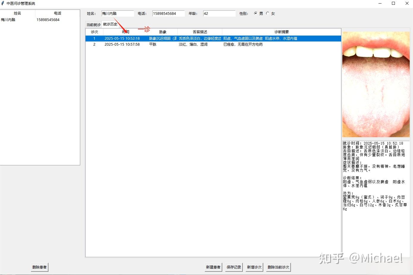 中医问诊辅助记录软件 - 知乎