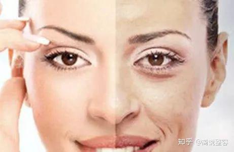 你的法令纹是如何一步一步加深的? - 知乎