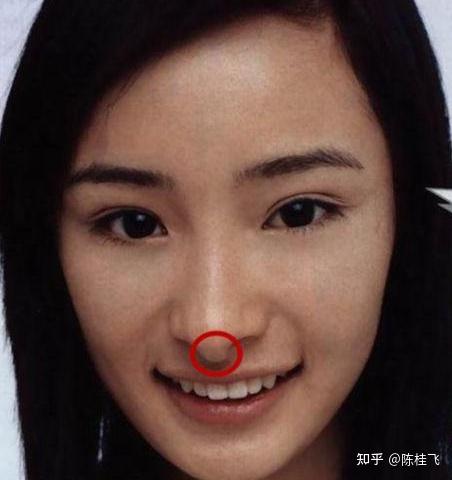 鼻小柱鼻翼的静态和动态平衡关系