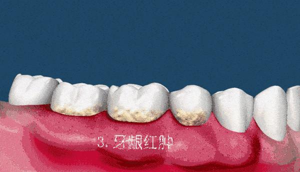 v2-f6225d7cacedefde23725004316f0745_r.jpg