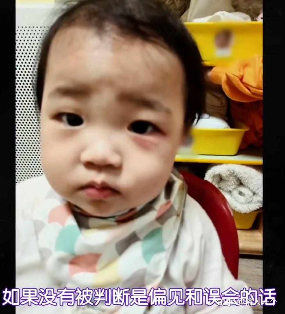 作为一岁宝宝的母亲看了韩国一岁半宝宝郑仁被虐待的新闻后心疼心痛