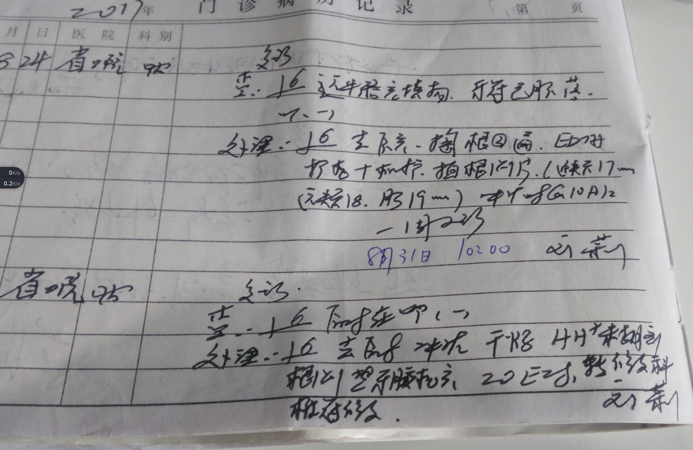什么时候必须做根管 v2-f6a63e07141a6f806b364879a219efe5_r.jpg