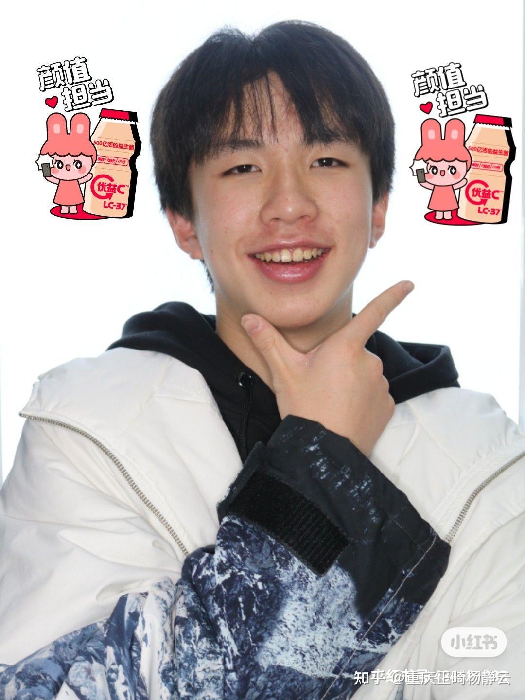 龅牙嘴突矫正案例分享12又一个大帅哥养成记