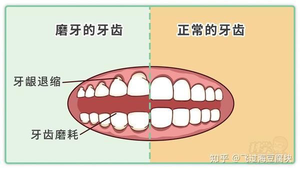 娃睡觉磨牙、张嘴、打呼、睁眼…当心是这些疾病在“作祟”! - 知乎