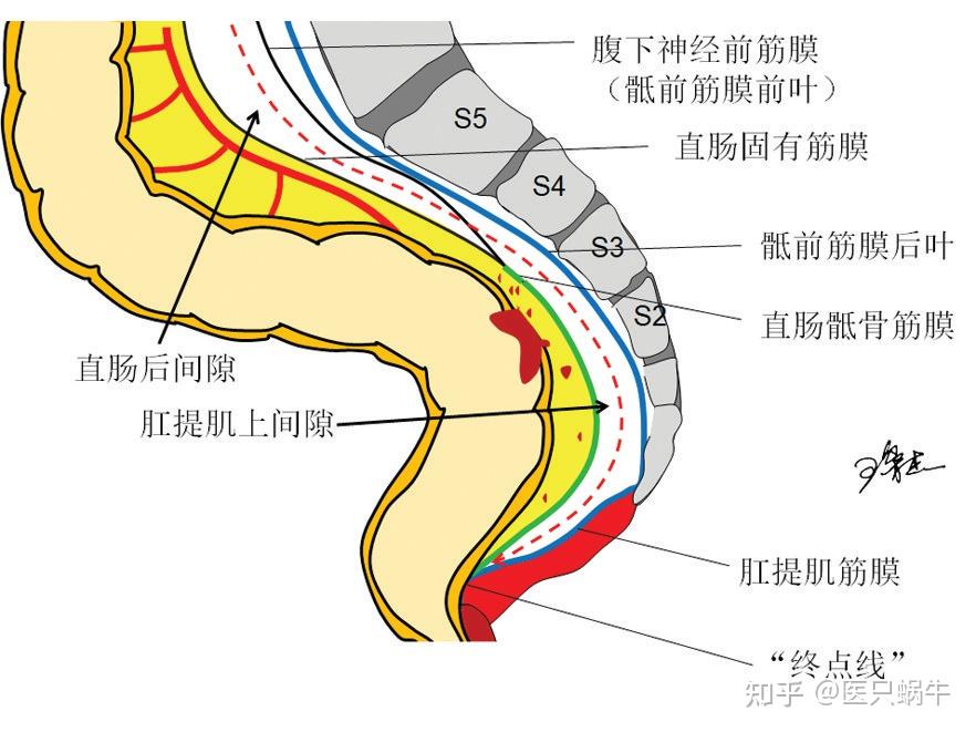 直肠系膜区解剖范围图片