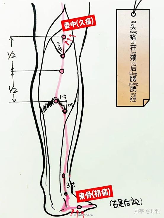 人纪针灸笔记（22）针灸治症系列（一） - 知乎