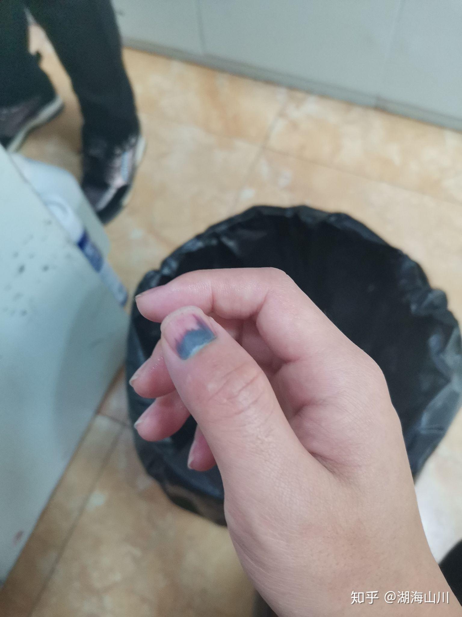 手被车门夹了怎么办