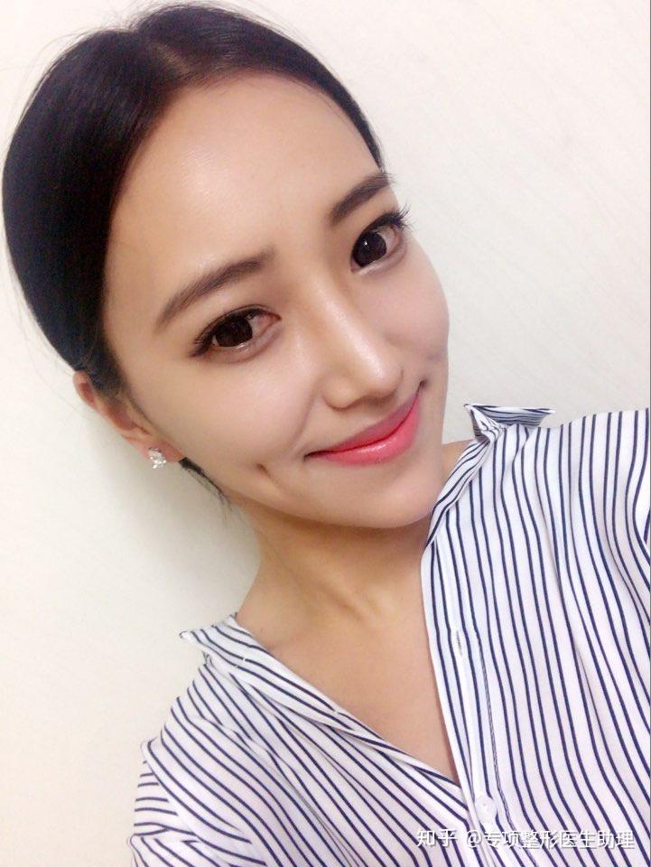 整容脸vs自然脸到底选哪个