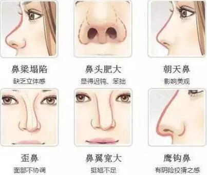 15种鼻型 你属于哪一种 知乎