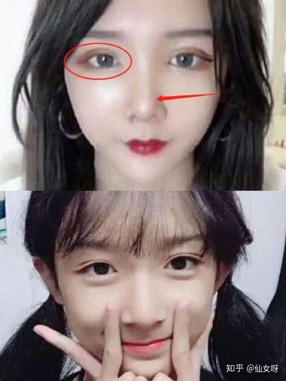 导致鼻部形态发生改变(7215所以答应我18岁以前不要想着整容好吗