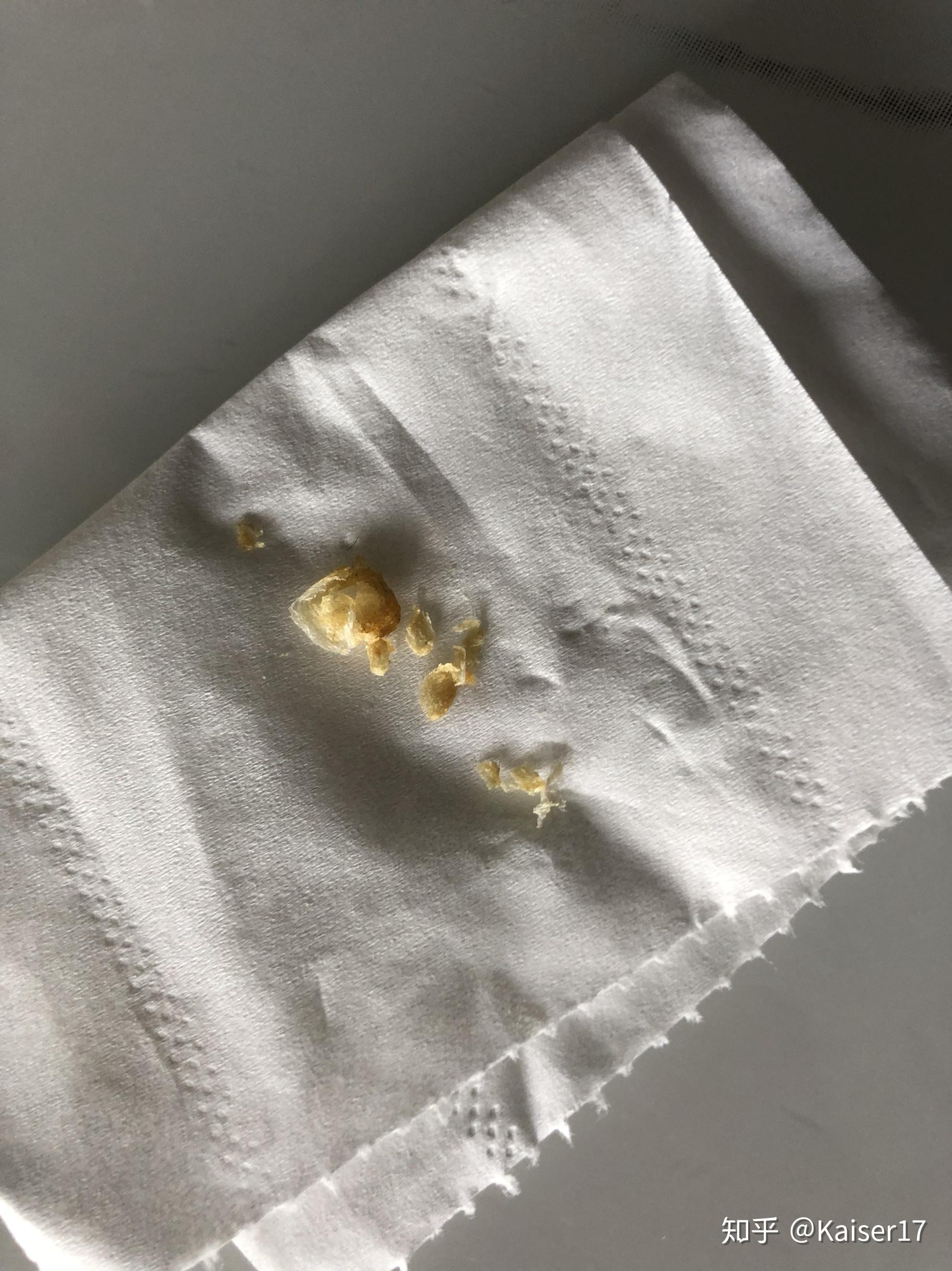 软化耳垢神器专治耳屎硬的问题