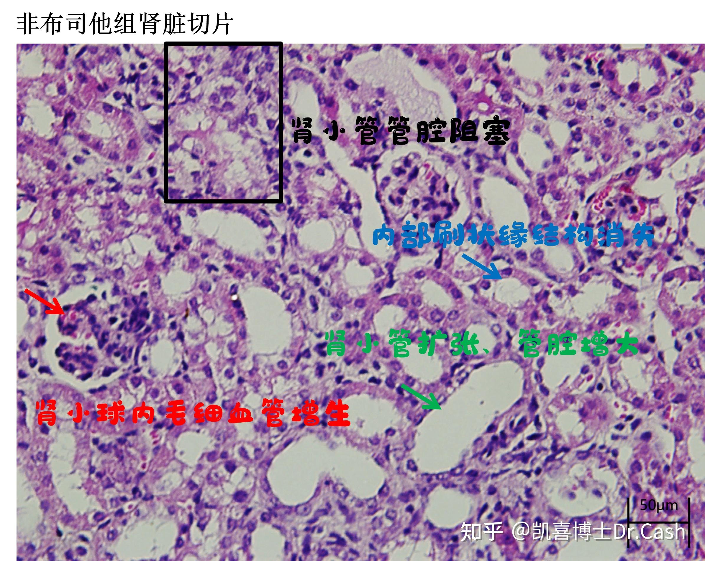 小鼠肾脏结构图图片