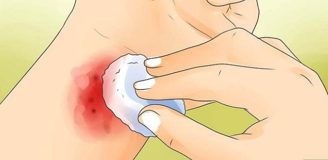 啥是开放性创伤 v2-f7ca1f8f8e3dd73b71b557fddc4a8de2_1440w.jpg?source=172ae18b