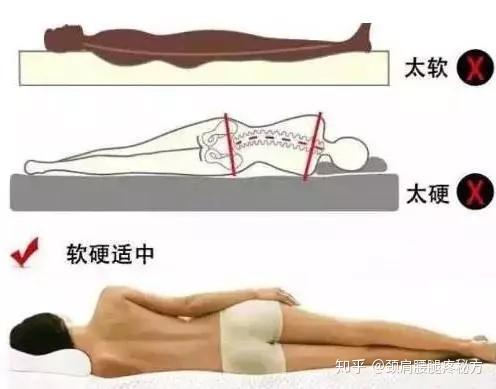 从腰椎间盘突出到坐骨神经痛 这个过程怎么度过与规避 知乎