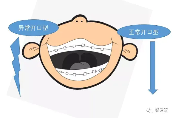 1 一般情况下,我们的张口度为自己的三横指,约3.7cm左右.