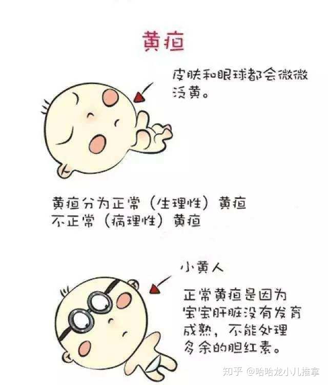 小儿出现黄疸怎么办