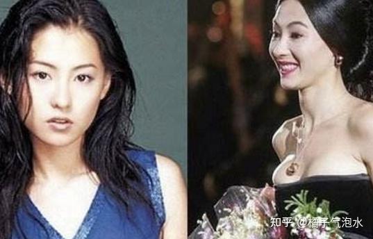 北京有哪些不错的隆胸专家，有人在北京做过隆胸吗？贵不贵 知乎 