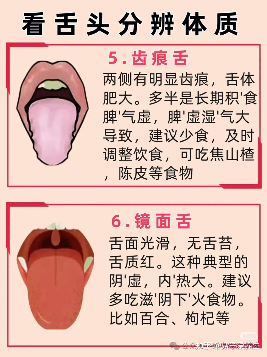 罗大伦教授 说“舌诊”是最巨直观的诊断方法！ - 知乎