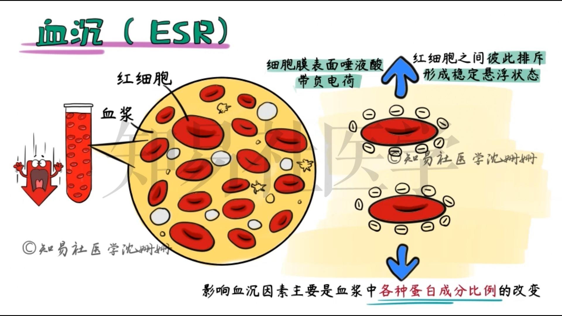 医学漫画精讲 | 【血沉】检测原理+临床意义 - 知乎