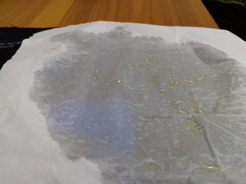 本人得了前列腺炎,这两年射出来的精子都是黄色的颗粒果冻?