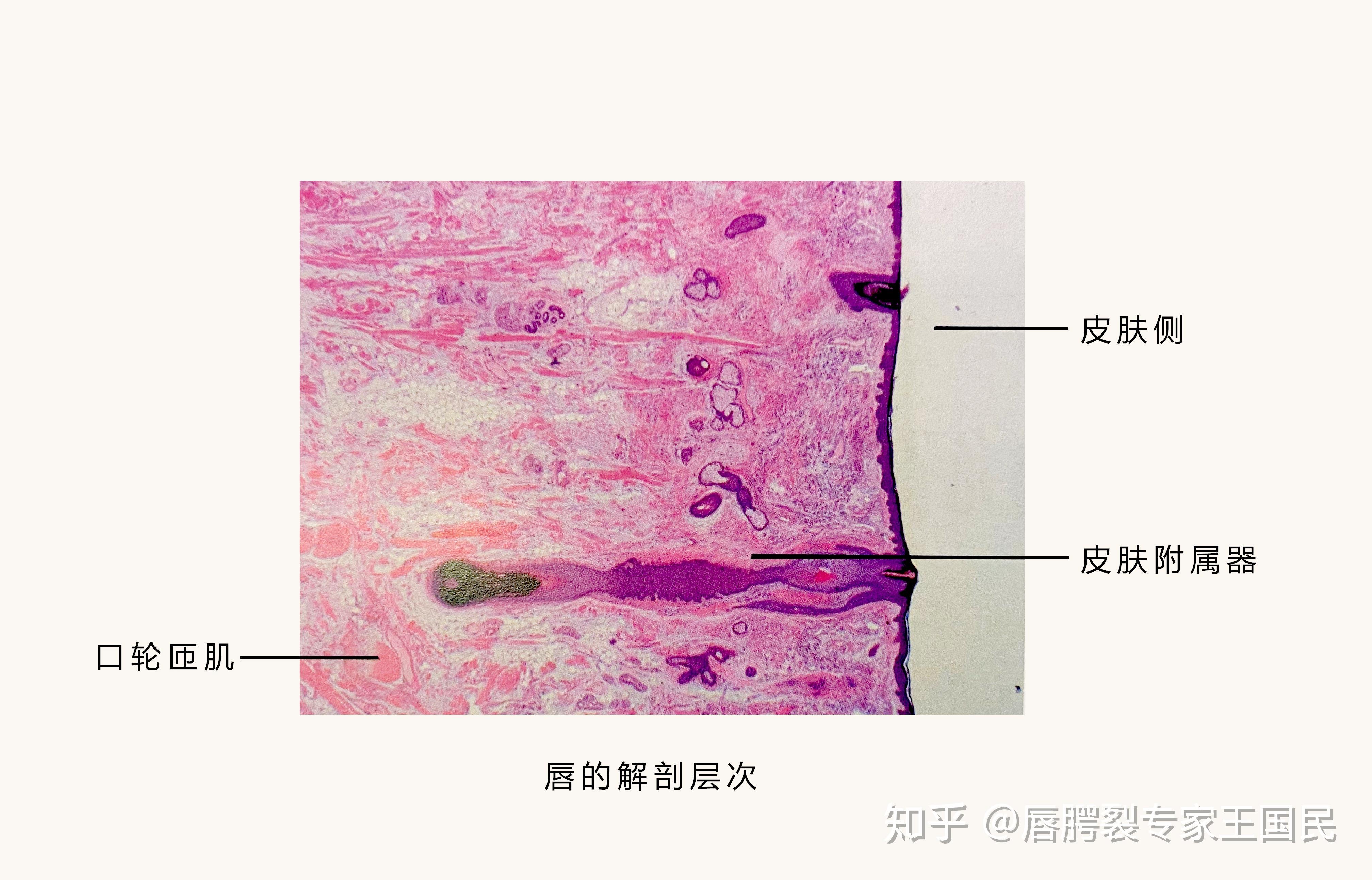 唇粘膜解剖结构图片