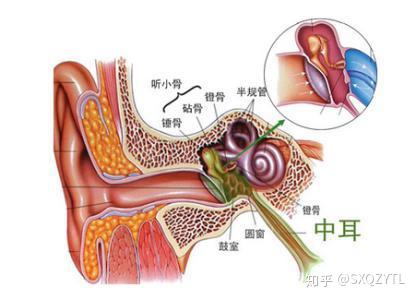 有关中耳积液的常见问题 知乎